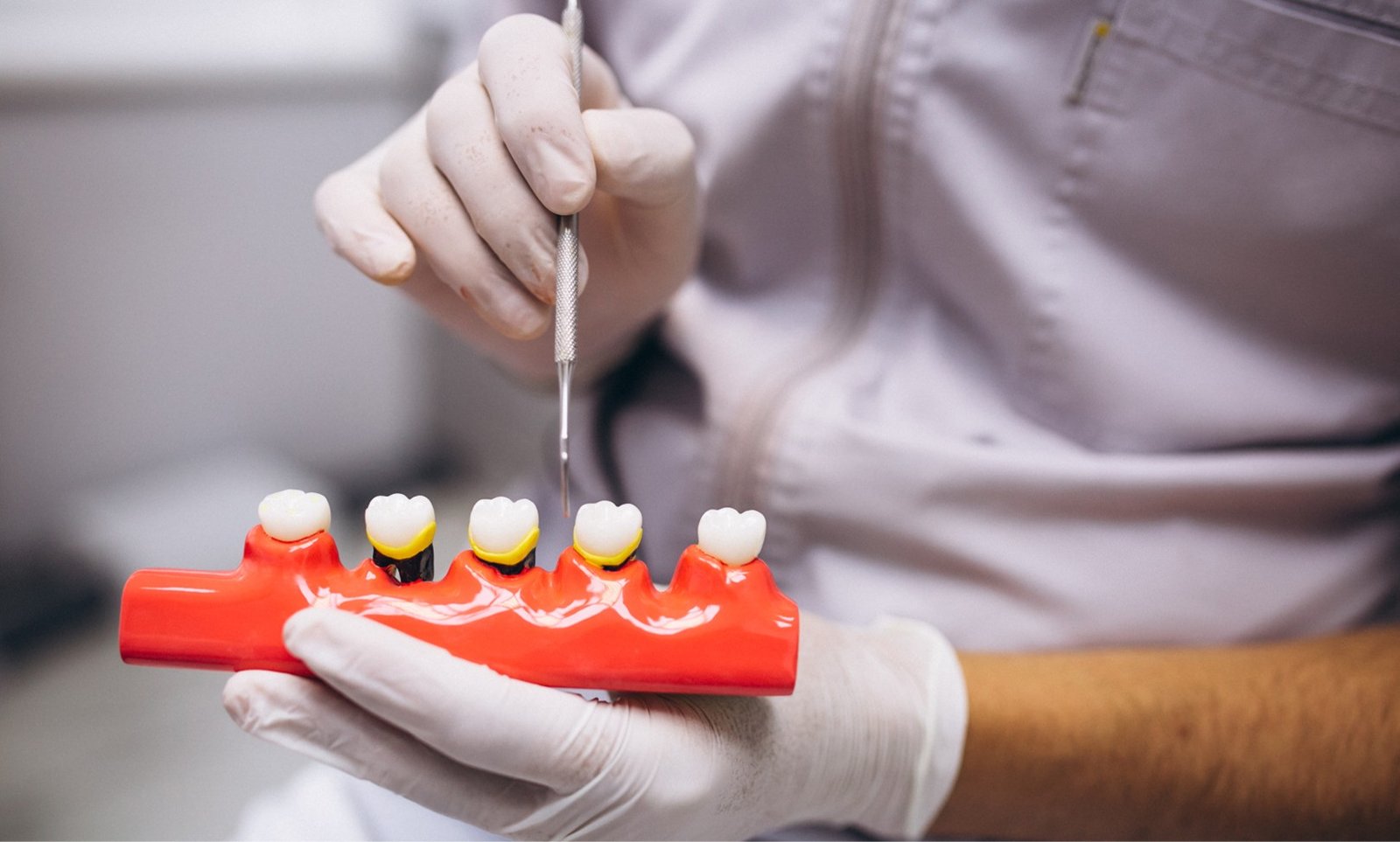 tratamiento-implantologia-mp-ellite-dental-1620x975