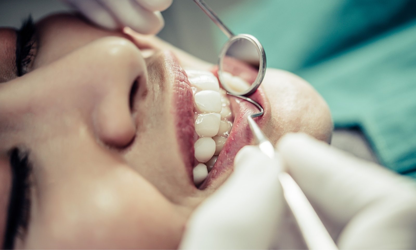 tratamiento-odontología-restauradora-mp-ellite-dental-1620x975